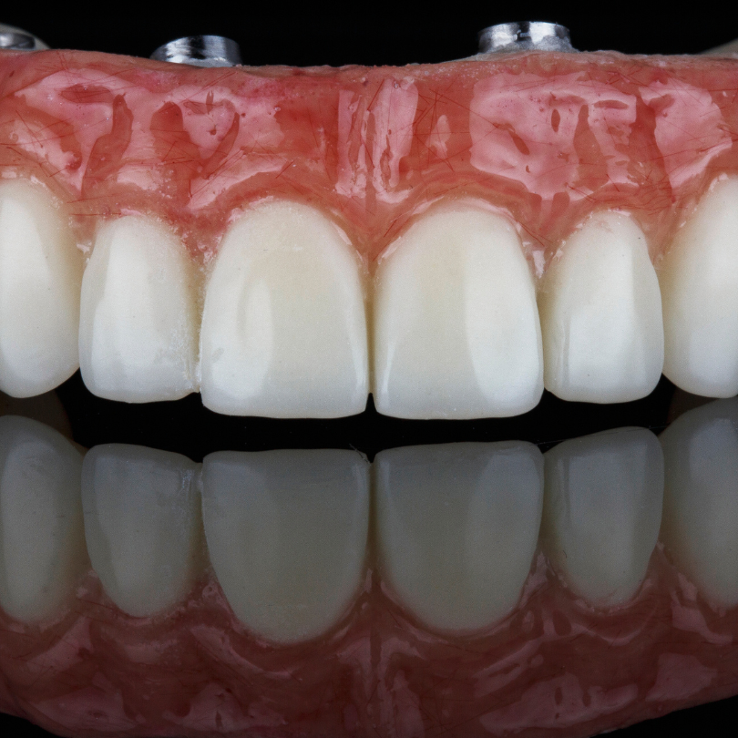 Implanturi dentare Brașov Proteze pe implanturi dentare Brașov Cost implant dentar Brașov Clinică implanturi dentare Brașov Specialist implanturi dentare Brașov Implant dentar all-on-4 Brașov Proteze dentare pe implanturi Brașov Preț proteze pe implanturi dentare Implant dentar fără durere Brașov Îngrijire după implant dentar Brașov Cea mai bună clinică de implanturi dentare Brașov Reabilitare orală cu implanturi dentare Brașov Implantologie avansată Brașov Avantaje proteze pe implanturi dentare Implanturi dentare rapide Brașov Cât costă un implant dentar în Brașov Implanturi dentare de calitate Brașov Tratamente moderne implant dentar Brașov Recuperare după proteze pe implanturi Brașov Estetica dentară cu implanturi în Brașov